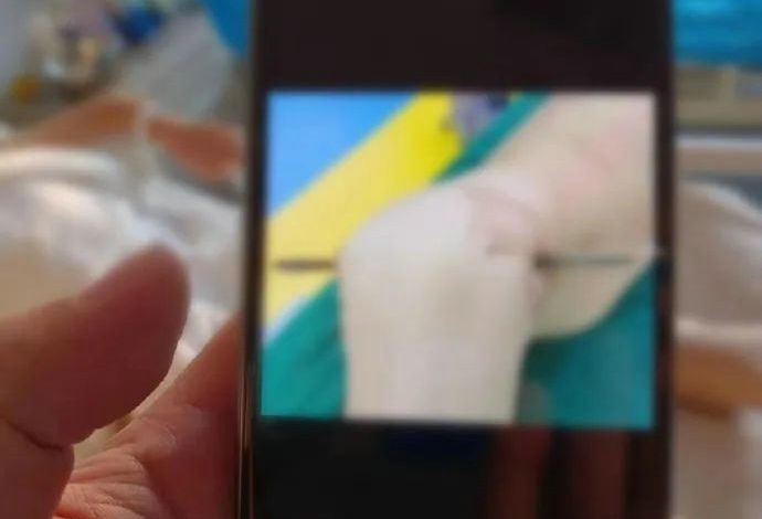 1700732946109485.jpg 2.jpg